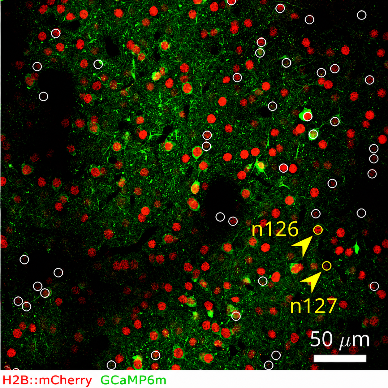 Two-photon microscopy image of mouse auditory cortex